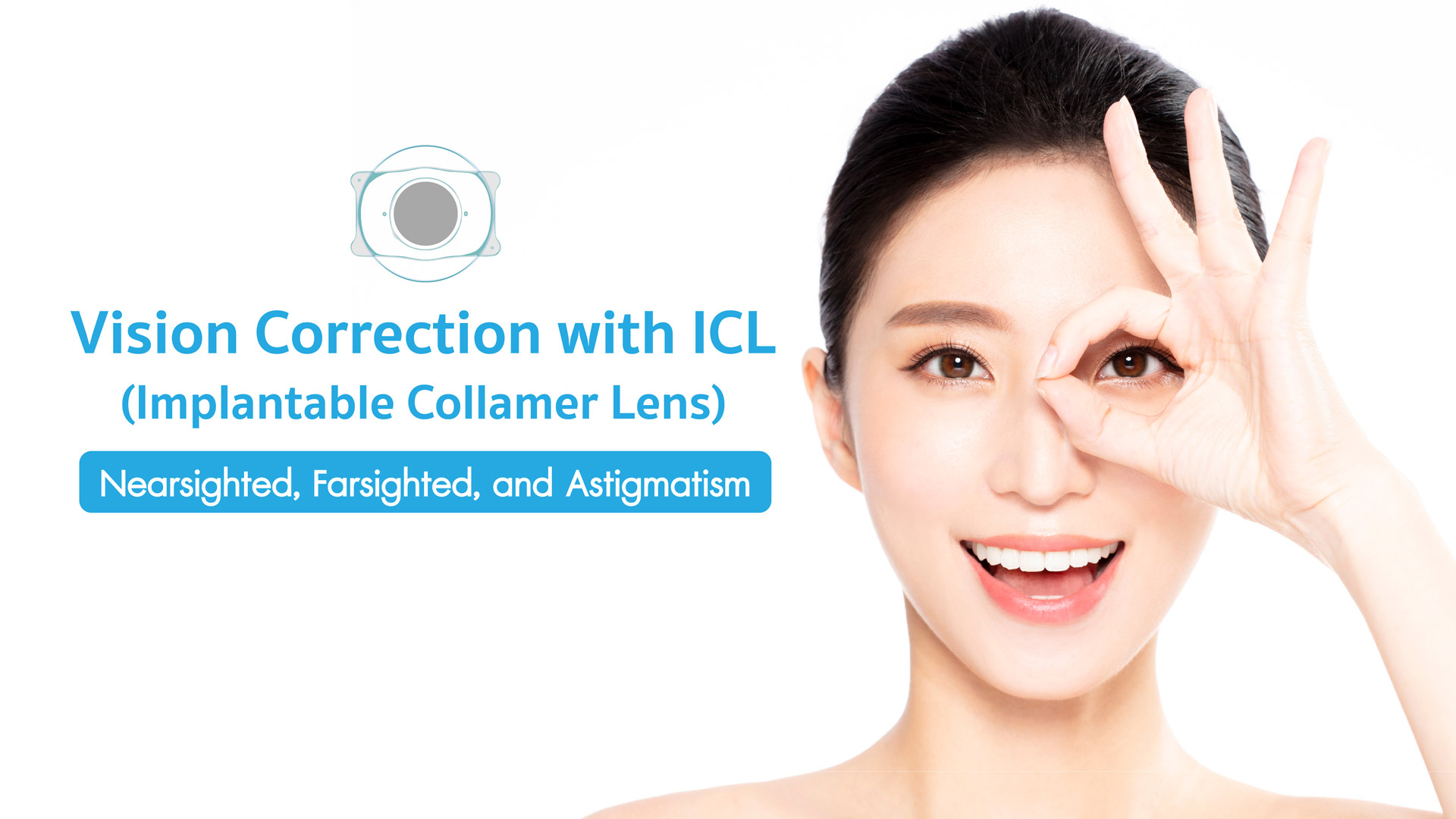 ICL Phakic Intraocular Lens for Nearsightedness, Farsightedness, and Astigmatism