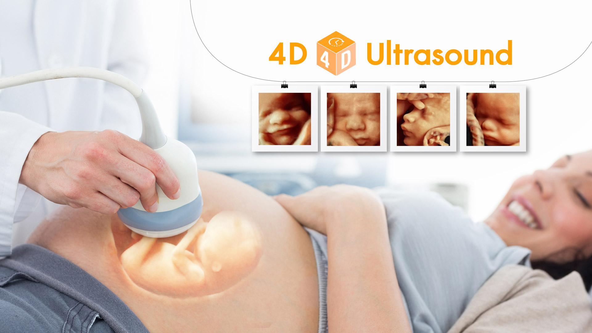 Ultrasound 4D