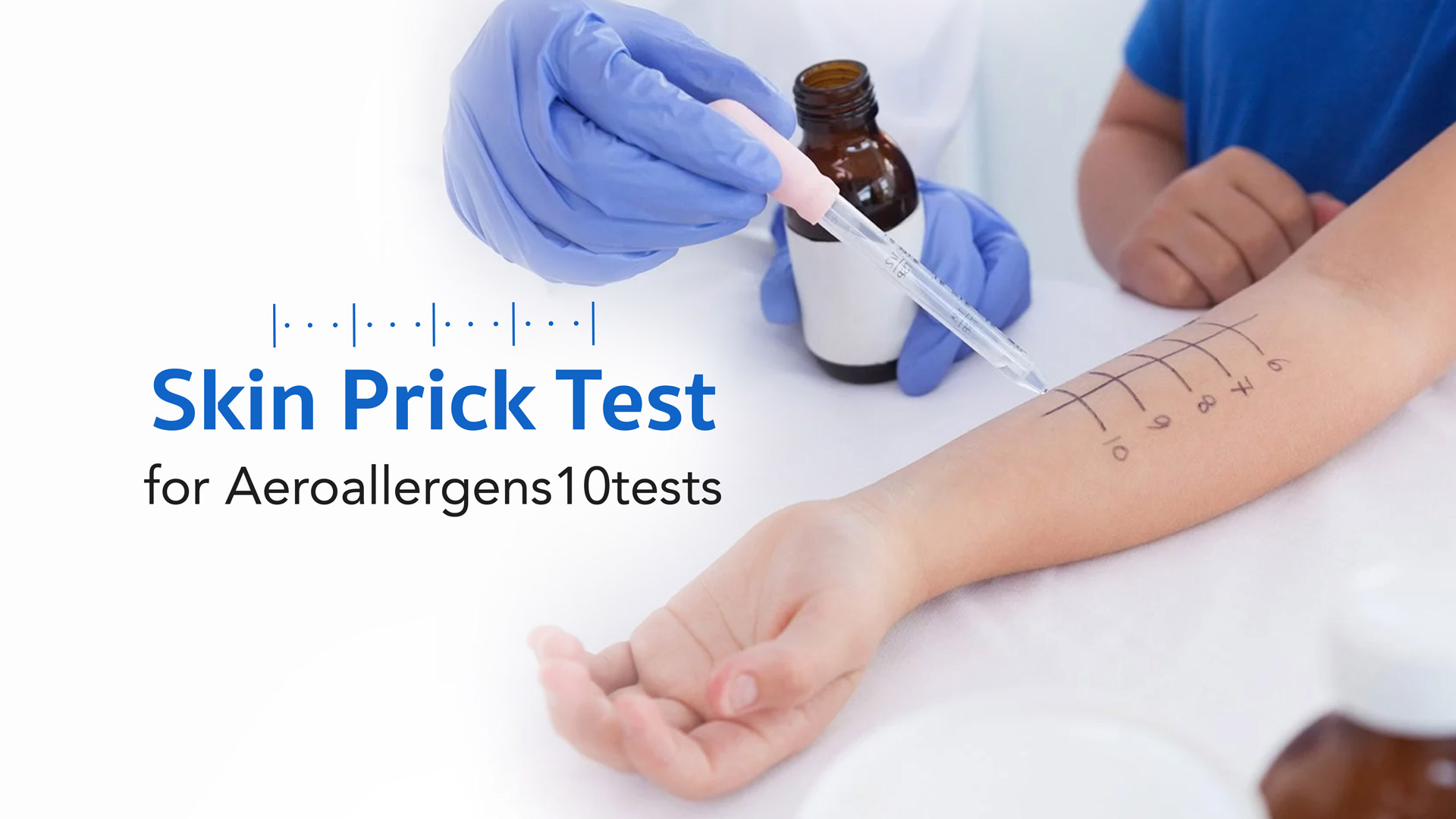 Skin Allergy Test