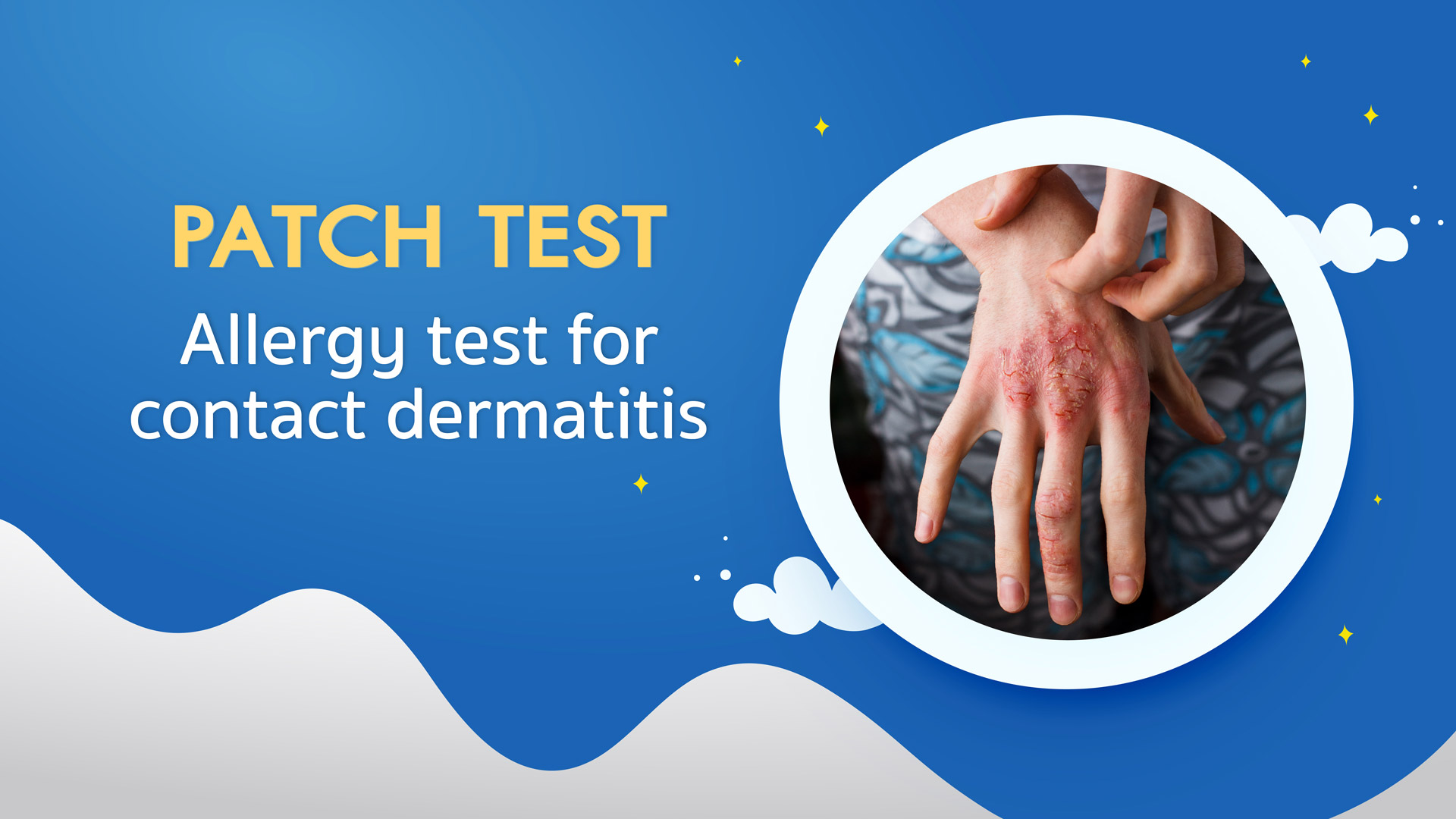 Patch Test