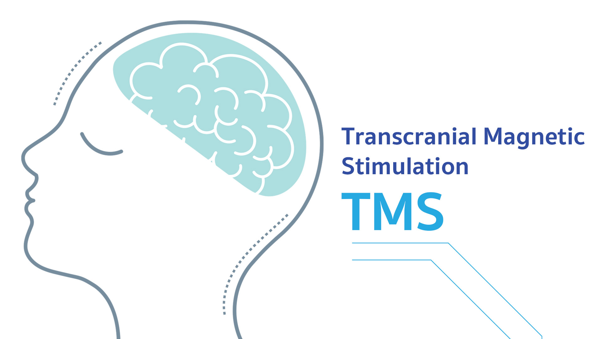 Transcranial Magnetic Stimulation (TMS)