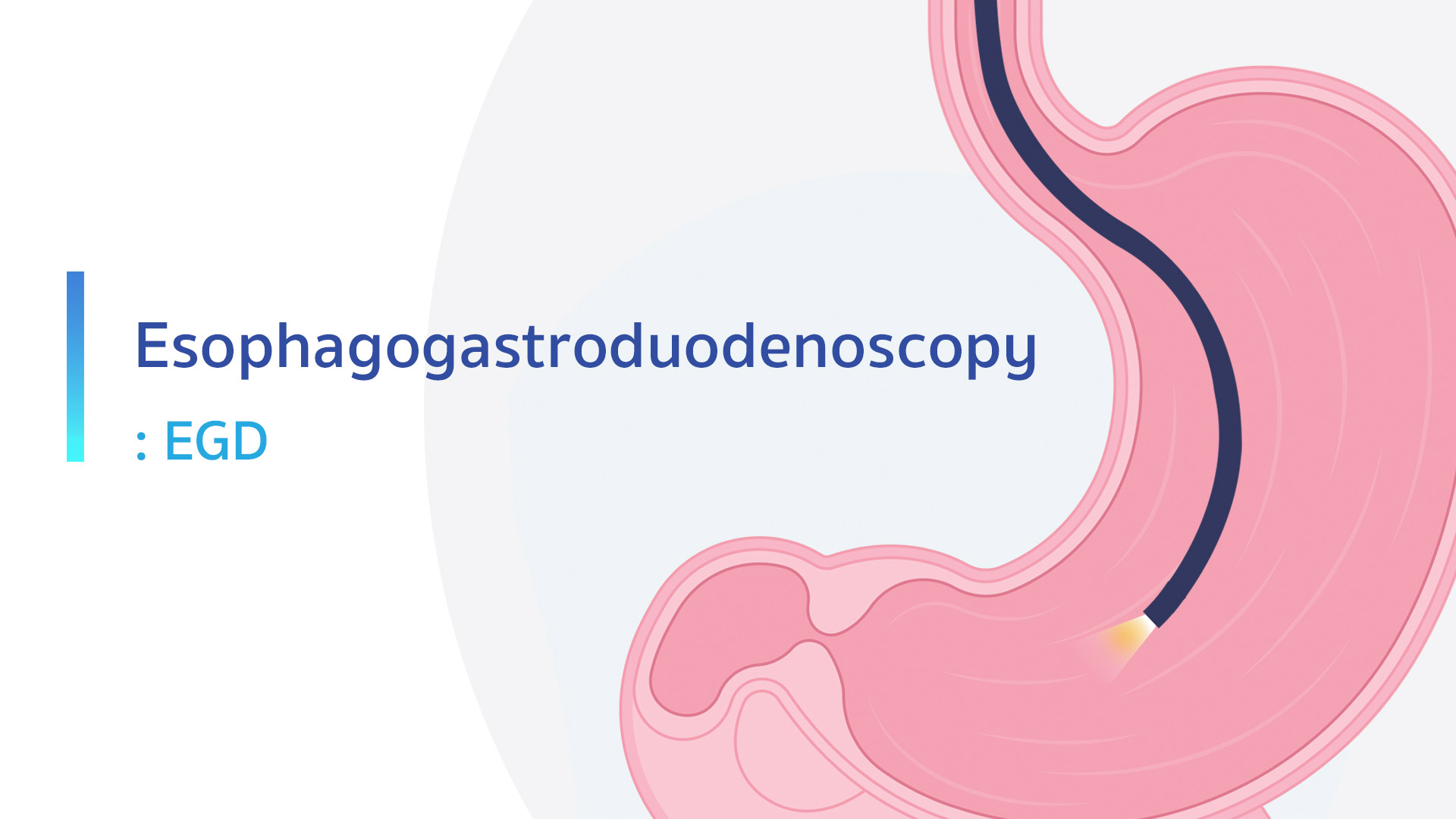 Gastroscopy