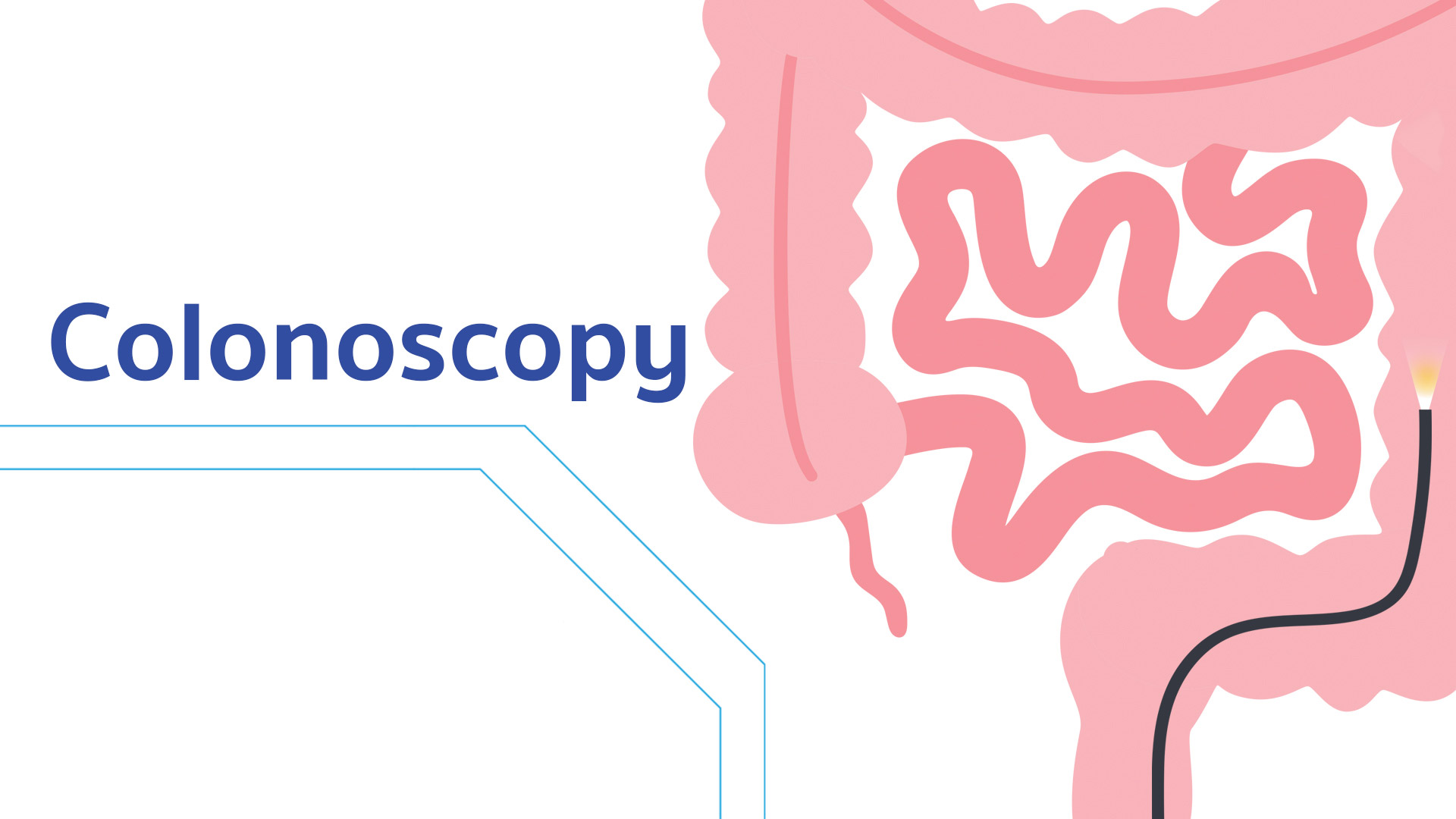 Colonoscopy