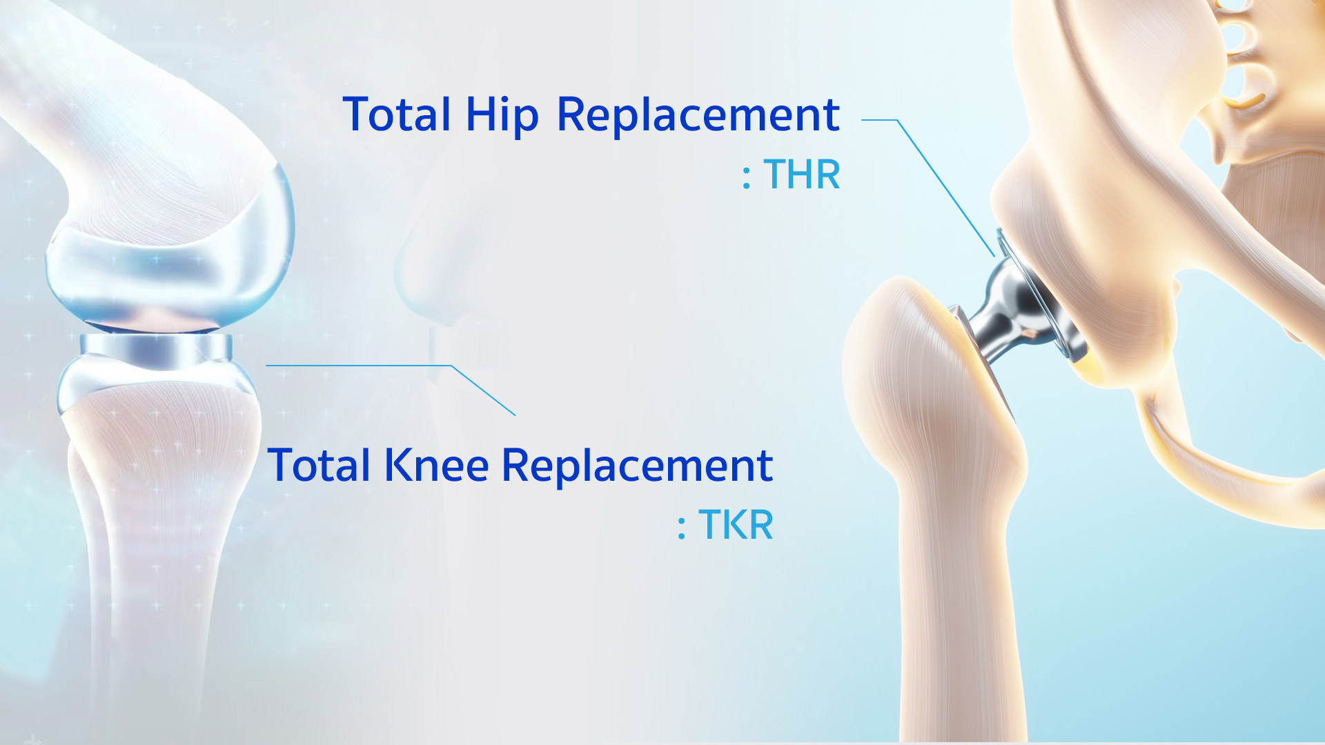 Knee / Hip Replacement