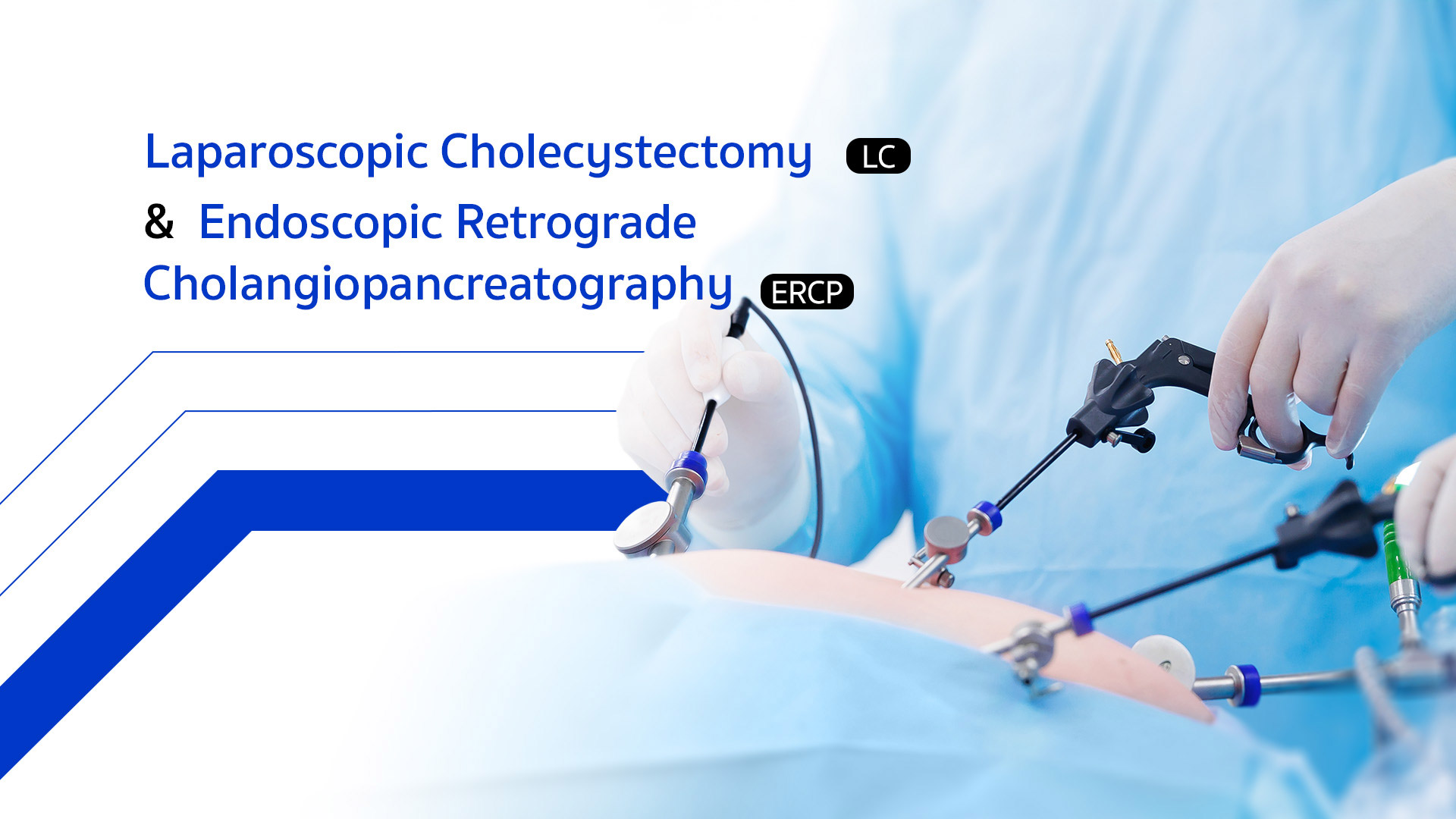 Laparoscopic Cholecystectomy & ERCP