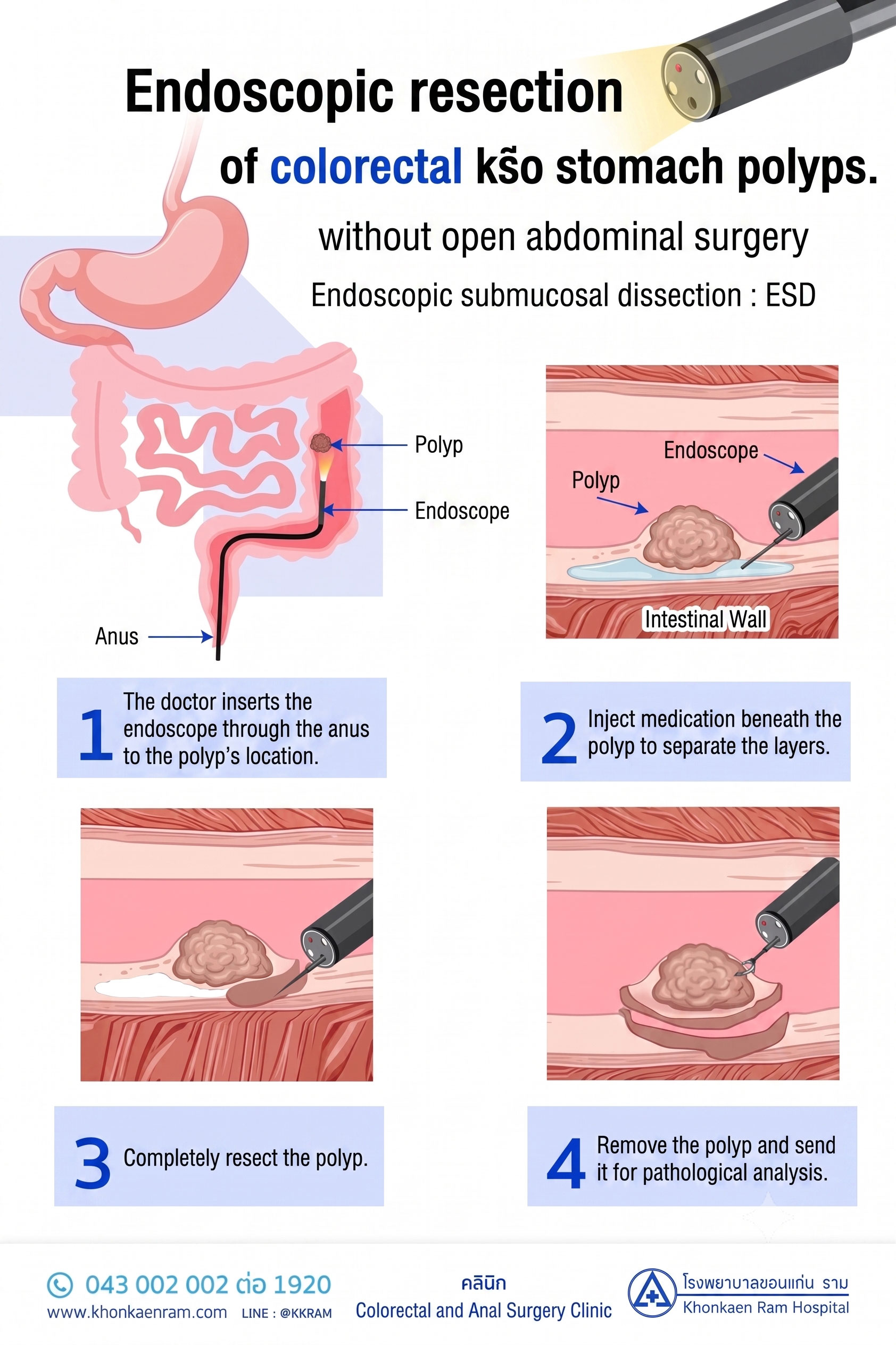 Esd Info Pic