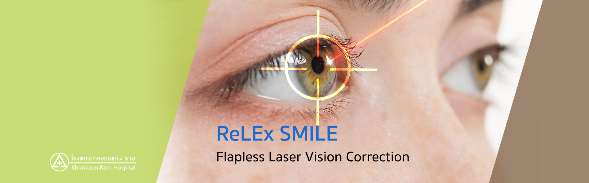 Slide web  lasik